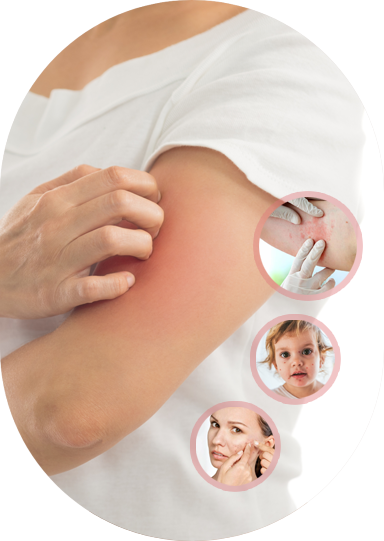 Dermatologist examining bacterial infection on patient’s arm