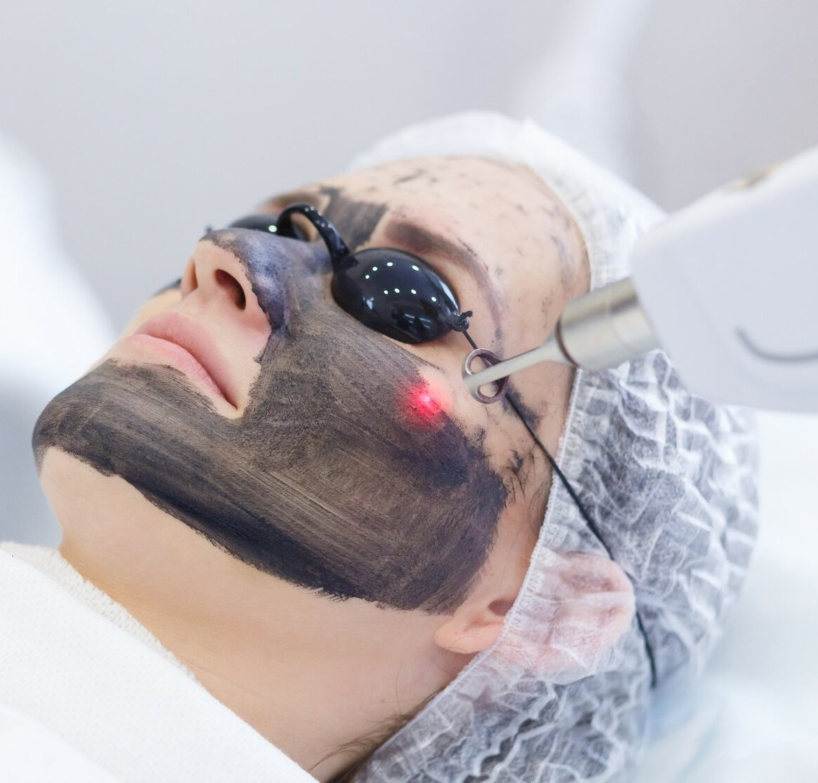 Advanced laser treatment in Kochi at SkinPal Clinic