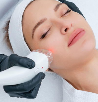 Laser therapy for reducing acne scars and post-inflammatory pigmentation