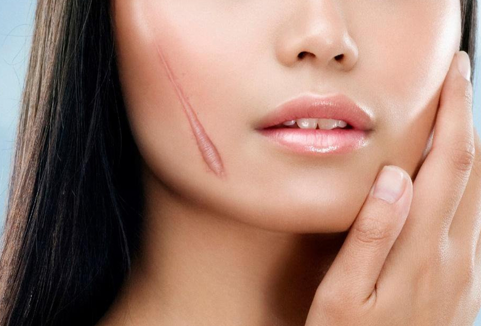surgical procedures to non-invasive treatment such as laser therapy and options ranging