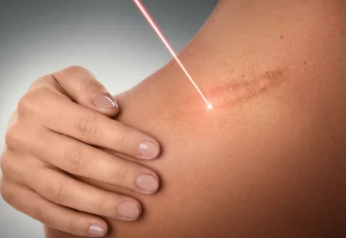 Professional eczema treatment for itchy, dry, and inflamed skin